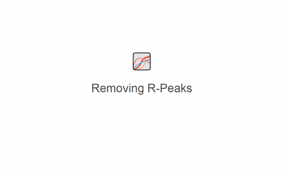 R-Peak rejection
